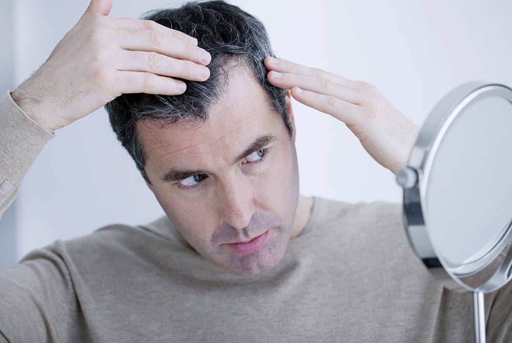 Effective Hair Loss Treatments in Birmingham: Restoring Confidence and Beauty