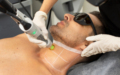 Unmasking the Myths: A Comprehensive Guide to Laser Hair Removal Birmingham