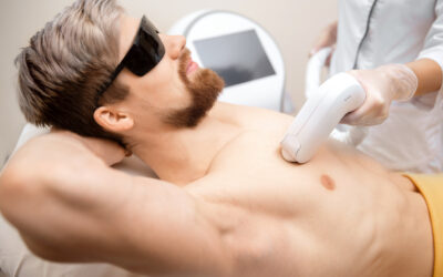 Discover the solution to flawless beauty with laser hair removal