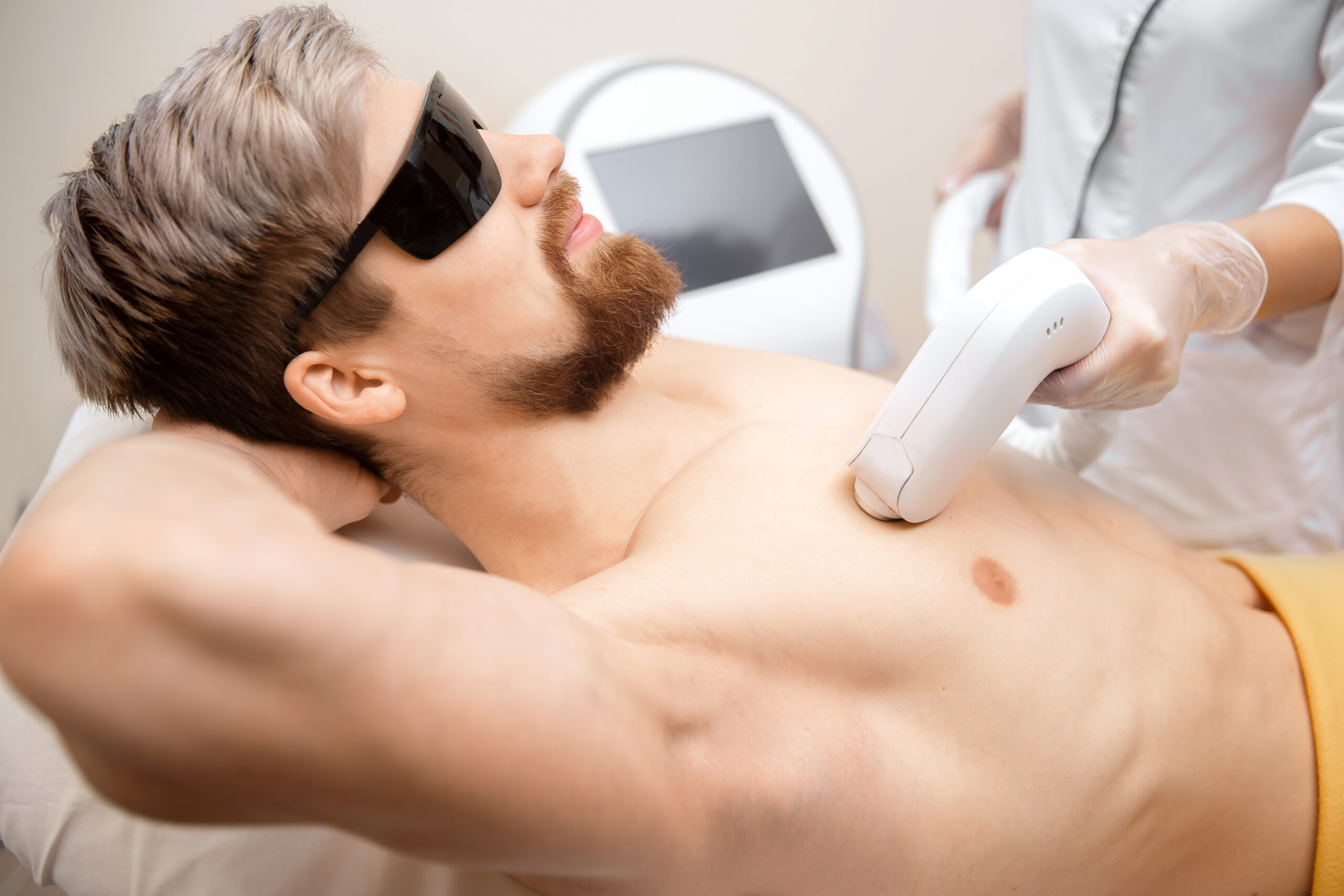 laser hair removal