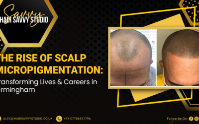 The Rise of Scalp Micropigmentation: Transforming Lives and Careers in Birmingham